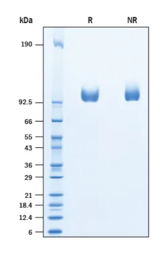 2 μg/lane Protein  was resolved with SDS-PAGE under reducing (R) and non-reducing (NR) conditions and visualized by Coomassie® Blue staining.